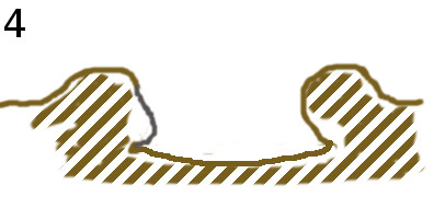 cicatrice4.jpg