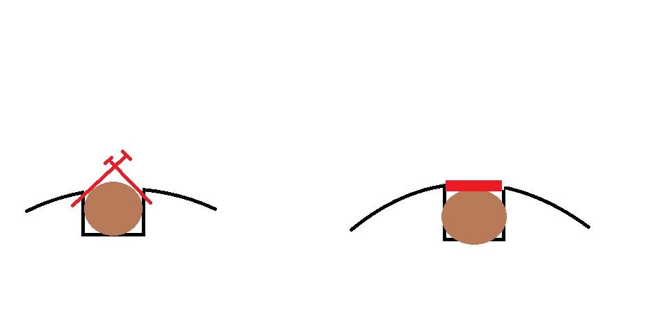 insertion.png