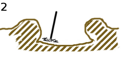cicatrice2.jpg